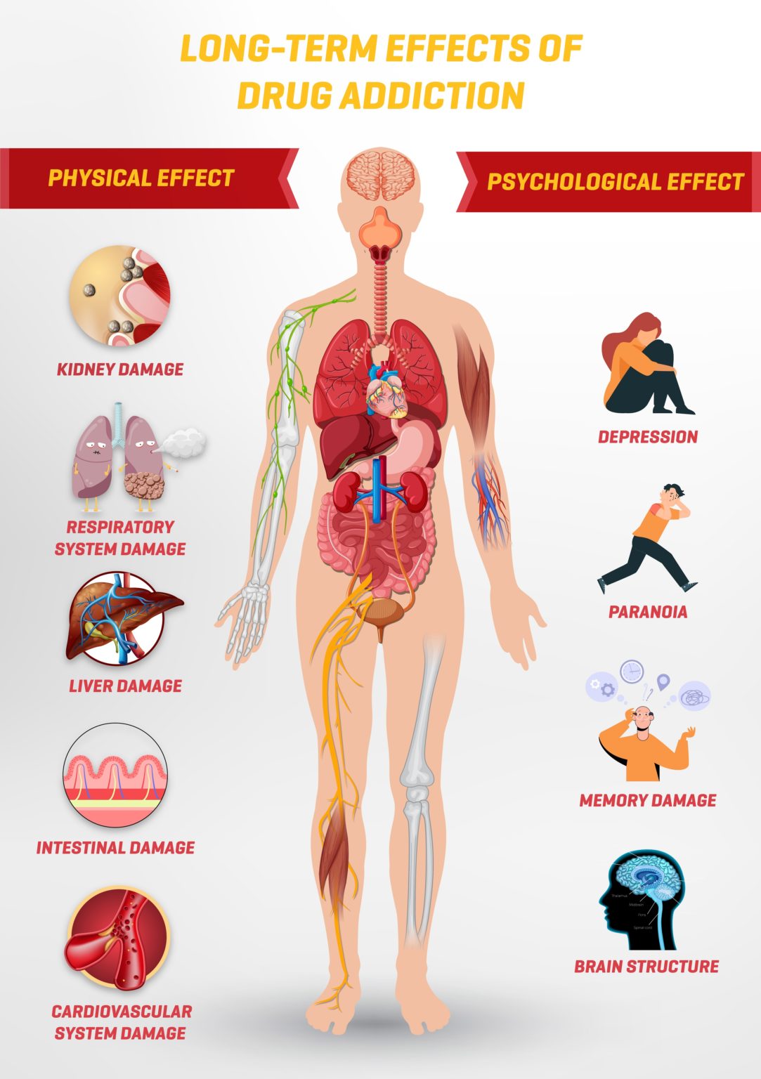 Long Term Effects Of Drug Addiction In Detail Lion Recovery